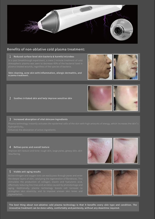 Plasma Pen Treatment in The Woodlands, TX | Naked SKN Aesthetics